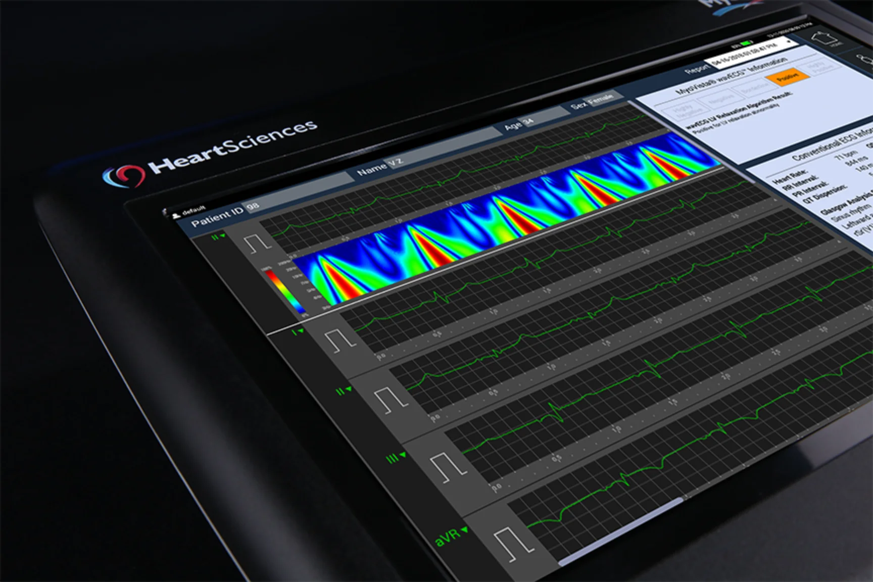 MyoVista wavECG™ device, three-quarter view